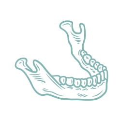 Jawbone Preparation Jawbone Preparation