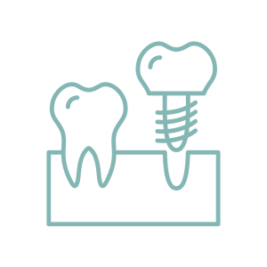 Need To Replace A Single Anterior Tooth Need To Replace A Single Anterior Tooth