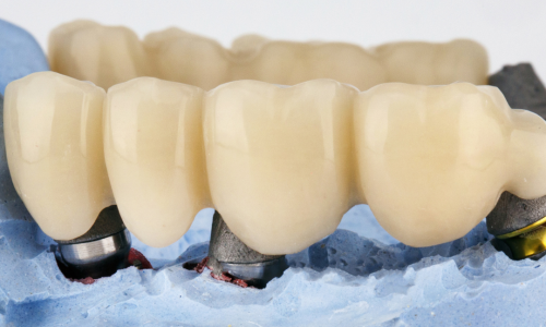 Restored Oral Health Restored Oral Health