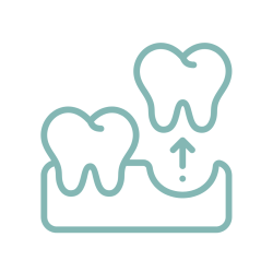Tooth Extraction (Implant) Tooth Extraction (Implant)